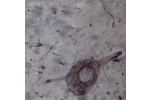 IHC on rat spinal cord (free floating sections) using Rabbit antibody to TRPC4  at a concentration of 20 µg/ml incubated overnight at room temperature with shake, developed with DAB/Ni. (TRPC4 antibody)