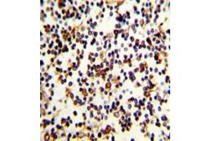 Image no. 2 for anti-Complement Component (3d/Epstein Barr Virus) Receptor 2 (CR2) (C-Term) antibody (ABIN452871) (CD21 antibody  (C-Term))