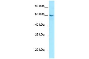 WB Suggested Anti-COL9A1 Antibody Titration: 1. (COL9A1 antibody  (N-Term))
