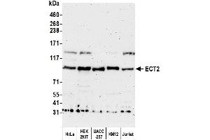 Western Blotting (WB) image for anti-Epithelial Cell Transforming Sequence 2 Oncogene (ECT2) (AA 833-883) antibody (ABIN7453075) (ECT2 antibody  (AA 833-883))