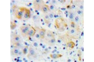 IHC-P analysis of Liver tissue, with DAB staining. (Growth Hormone Receptor antibody  (AA 315-574))