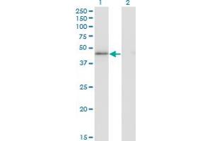 Western Blot analysis of HMG20A expression in transfected 293T cell line by HMG20A monoclonal antibody (M01), clone 4D5. (HMG20A antibody  (AA 153-262))
