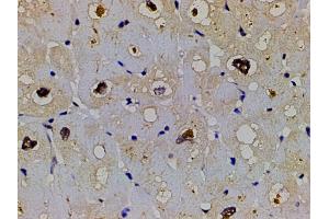 ABIN6267554 at 1/200 staining human heart tissue sections by IHC-P.