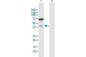 Western Blot analysis of ZNF396 expression in transfected 293T cell line by ZNF396 MaxPab polyclonal antibody. (ZNF396 antibody  (AA 1-333))