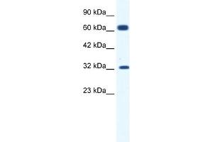 WB Suggested Anti-KCNN1 Antibody Titration:  1. (KCNN1 antibody  (C-Term))