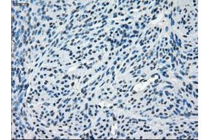 Immunohistochemical staining of paraffin-embedded endometrium tissue using anti-CRYABmouse monoclonal antibody. (CRYAB antibody)