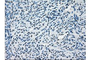 Immunohistochemical staining of paraffin-embedded endometrium tissue using anti-CRYABmouse monoclonal antibody. (CRYAB antibody)