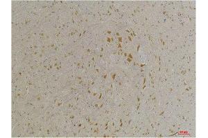 Immunohistochemistry (IHC) analysis of paraffin-embedded Mouse Brain Tissue using GABA A Receptor alpha4 Rabbit Polyclonal Antibody diluted at 1:200. (GABRA4 antibody)