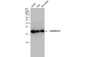 WB Image GABARAPL2 antibody detects GABARAPL2 protein by western blot analysis. (GABARAPL2 antibody  (Center))