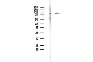 Western blot analysis of lysates from HepG2 cells(heat-shock,45 min treatment), using Choline Acetyltransferase Antibody at 1/1000 dilution.