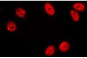 ABIN6275711 staining HepG2 by IF/ICC. (Zinc Finger and SCAN Domain Containing 25 (ZSCAN25) (Internal Region) antibody)