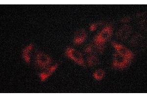 ABIN6274195 staining A549 cells by ICC/IF. (TNFRSF1B antibody  (C-Term))
