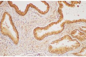 Immunohistochemistry of paraffin-embedded Human prostate gland using HRAS Polycloanl Antibody at dilution of 1:200 (HRAS antibody)