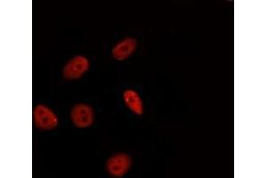 ABIN6277331 staining Hela by IF/ICC. (HSF2 antibody  (Internal Region))