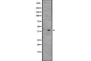 Western blot analysis of CENPL expression in HT1080 whole cell lysate ;,The lane on the left is treated with the antigen-specific peptide. (CENPL antibody  (Internal Region))