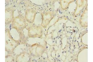 Immunohistochemistry of paraffin-embedded human kidney tissue using ABIN7173095 at dilution of 1:100 (TMEM174 antibody  (AA 94-243))