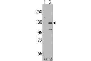 Western Blotting (WB) image for anti-Dishevelled Associated Activator of Morphogenesis 1 (DAAM1) antibody (ABIN3001578)