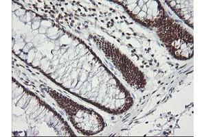 Immunohistochemical staining of paraffin-embedded Human colon tissue using anti-MCTS1 mouse monoclonal antibody.