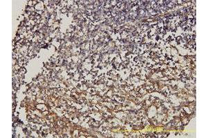Immunohistochemistry (Formalin-fixed Paraffin-embedded Sections) (IHC (fp)) image for anti-CD58 (CD58) (AA 1-240) antibody (ABIN560255)
