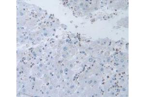 DAB staining on IHC-P; Samples: Human Liver Tissue (IL-19 antibody  (AA 25-177))