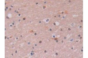 Detection of LOXL2 in Human Cerebrum Tissue using Polyclonal Antibody to Lysyl Oxidase Like Protein 2 (LOXL2) (LOXL2 antibody  (AA 544-751))