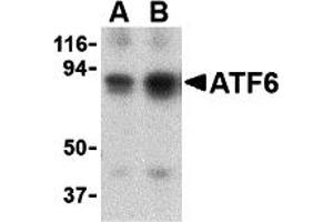 Western Blotting (WB) image for anti-Activating Transcription Factor 6 (ATF6) (N-Term) antibody (ABIN1031243) (ATF6 antibody  (N-Term))