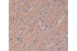 Used in DAB staining on fromalin fixed paraffin- embedded brain tissue (PTPN5 antibody  (AA 331-558))