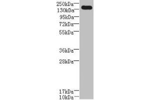 UBE2O 抗体  (AA 10-277)