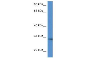 WB Suggested Anti-Scamp5 Antibody Titration: 1.