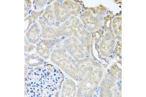 Immunohistochemistry of paraffin-embedded mouse kidney using MYLK antibody.