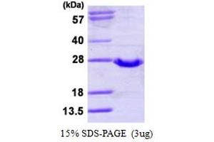 SDS-PAGE (SDS) image for Glutathione Peroxidase 2/GPX2 (U40C) (AA 1-190) protein (His tag) (ABIN6386856) (Glutathione Peroxidase 2/GPX2 (U40C) (AA 1-190) protein (His tag))