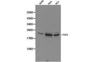 Western Blotting (WB) image for anti-Fibroblast Growth Factor 2 (Basic) (FGF2) antibody (ABIN1872685) (FGF2 antibody)