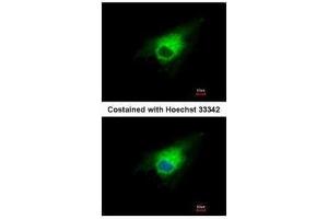 ICC/IF Image Immunofluorescence analysis of methanol-fixed A549, using PGD, antibody at 1:500 dilution.