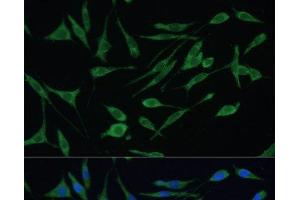 Immunofluorescence analysis of L929 cells using ARHGAP25 Polyclonal Antibody at dilution of 1:100 (40x lens). (ARHGAP25 antibody)