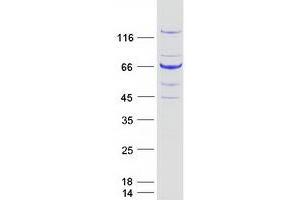 Validation with Western Blot