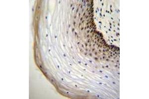 Immunohistochemistry analysis in formalin fixed and paraffin embedded human cervical tissue reacted with NUP107 Antibody (Center) followed by peroxidase conjugation of the secondary antibody and DAB staining. (NUP107 antibody  (Middle Region))