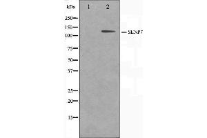 Western blot analysis on HuvEc cell lysate using SENP7 Antibody,The lane on the left is treated with the antigen-specific peptide. (SENP7 antibody  (C-Term))