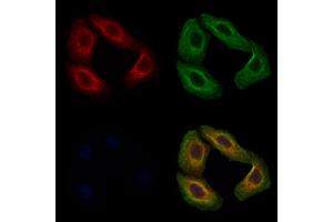 ABIN7093916 and ABIN7097960 staining Hela cells by IF/ICC. (POMGNT1 antibody  (C-Term))