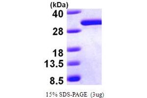 SDS-PAGE (SDS) image for Dicarbonyl/L-Xylulose Reductase (DCXR) (AA 1-244) protein (His tag) (ABIN667141) (DCXR Protein (AA 1-244) (His tag))