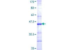 CHST1 Protein (AA 168-267) (GST tag)