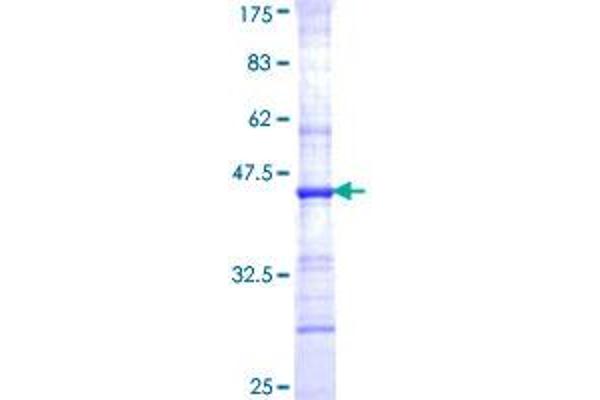 CHST1 Protein (AA 168-267) (GST tag)