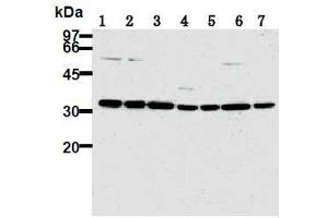 Western Blotting (WB) image for anti-Cyclin-Dependent Kinase 2 (CDK2) antibody (ABIN1106646) (CDK2 antibody)
