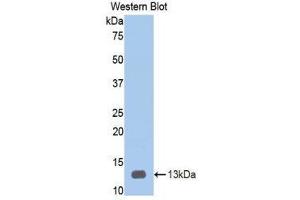 Western Blotting (WB) image for anti-Heparanase (HPSE) (AA 34-115) antibody (ABIN1859190) (HPSE antibody  (AA 34-115))