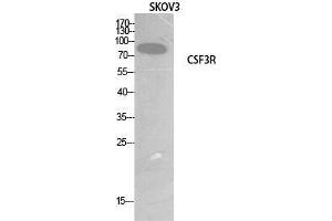 Western Blot (WB) analysis of SKOV3 cells using G-CSFR Polyclonal Antibody. (CSF3R antibody  (Internal Region))