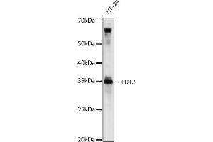 Western blot analysis of extracts of HT-29 cells, using FUT2 antibody (ABIN6129014, ABIN6140822, ABIN6140823 and ABIN6221384) at 1:1000 dilution. (FUT2 antibody  (AA 29-150))