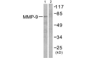 Western Blotting (WB) image for anti-Matrix Metallopeptidase 9 (Gelatinase B, 92kDa Gelatinase, 92kDa Type IV Collagenase) (MMP9) (C-Term) antibody (ABIN1848692) (MMP 9 antibody  (C-Term))