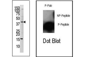 Image no. 2 for anti-Jun Proto-Oncogene (JUN) (pSer63) antibody (ABIN358110) (C-JUN antibody  (pSer63))