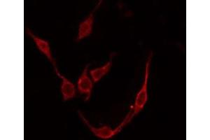 ABIN6276059 staining COLO205 by IF/ICC. (TACR3 antibody  (C-Term))