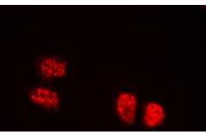Immunofluorescent analysis of TCOF1 staining in HEK293T cells. (TCOF1 antibody  (N-Term))