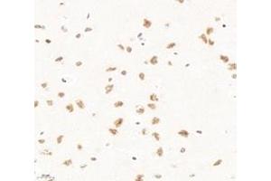 Immunohistochemistry (Paraffin-embedded Sections) (IHC (p)) image for anti-Polyglutamine Binding Protein 1 (PQBP1) antibody (ABIN7075126)